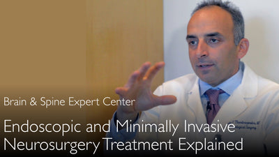 טיפול בגידולי מוח בבסיס הגולגולת. שיטות נוירוכירורגיה אנדוסקופיות פולשניות מינימליות. 2