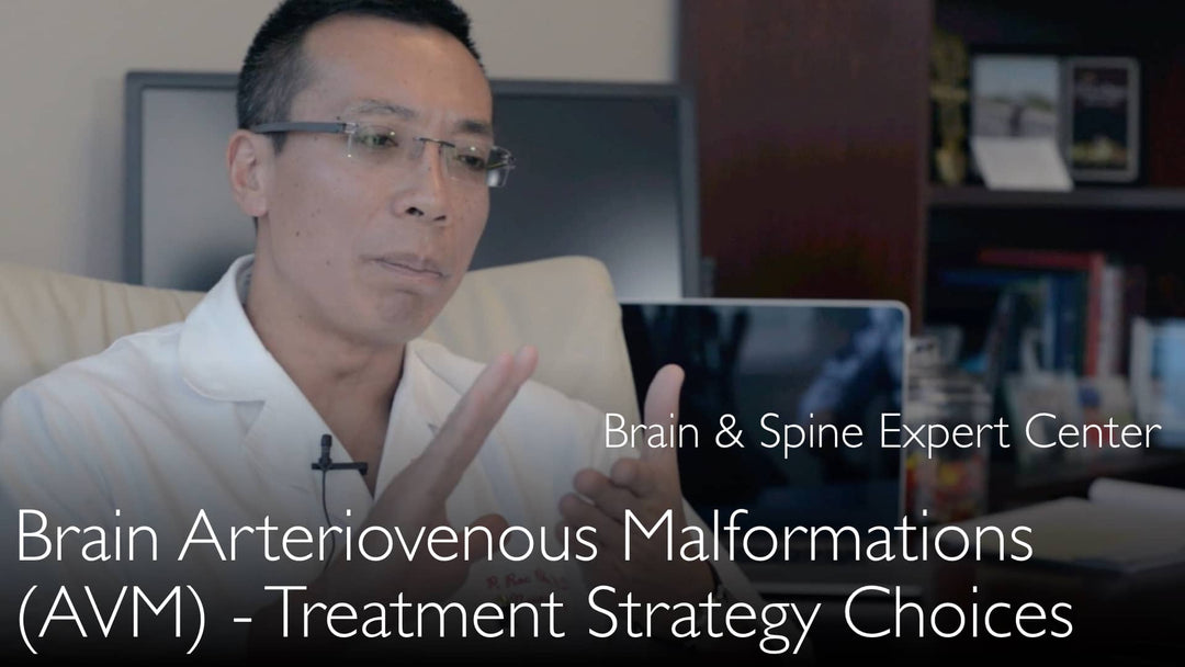 Brain arteriovenous malformation treatment. AVM therapy. 9